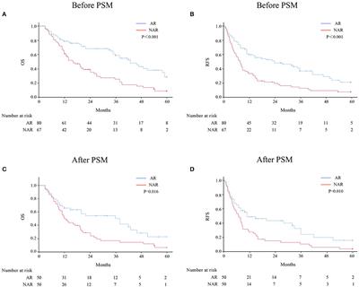 Long-term outcomes of anatomic vs. non-anatomic resection in intrahepatic cholangiocarcinoma with hepatolithiasis: A multicenter retrospective study